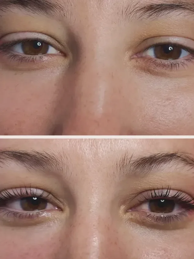 Resultado de lifting de pestañas: antes y después